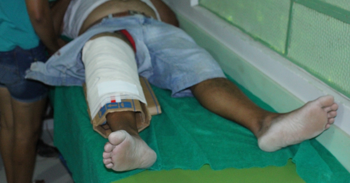 Vítima deu entrada no hospital da cidade com perna fraturada em dois lugares (Crédito: Gustavo Lopes/BR104)