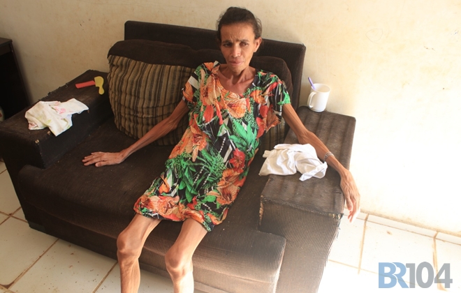 O caso é de Santana do Mundaú, Zona da Mata do estado; mulher pesa apenas 30 kg e sofre com doenças (Crédito: Josenildo Feitosa/BR104)