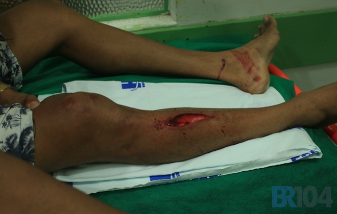 Jackson teve ferimentos na perna direita e foi encaminhado ao hospital do município (Crédito: Gustavo Lopes/BR104)