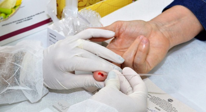 Após realização de exame confirmatório, portadores do vírus são encaminhados para o Ambulatório da Sesau (Crédito Carla Cleto)