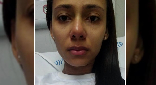 Há quinze anos a jovem Surhana Guedes, de 26 anos, de Santana do Mundaú, convive com a endometriose profunda infiltrativa (Crédito: Cortesia)