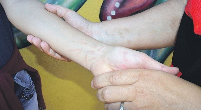 O texto incluiu ainda a criação de um sistema nacional, envolvendo estados e municípios, para prevenção da automutilação e do suicídio (Crédito: Ilustração)