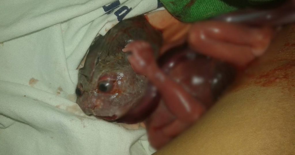 Bebê nasceu com ‘cara de cobra’ no interior de Alagoas?