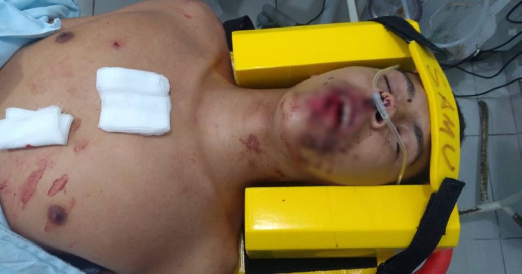 Vítima de tentativa de homicídio em União está em estado grave