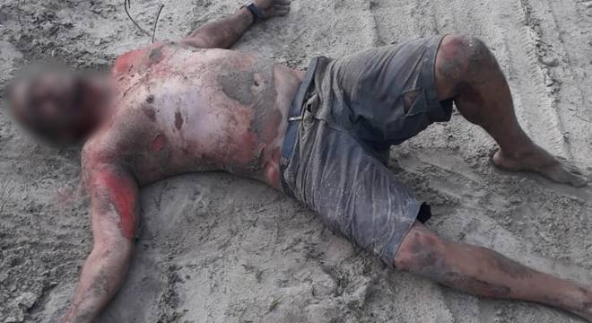 Vítima foi encaminhada para o Hospital Geral do Estado (HGE), em Maceió; estado de saúde é considerado grave — © Cortesia