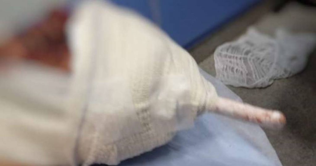 Com faca cravada na cabeça, jovem vai para casa e pede ajuda a familiares