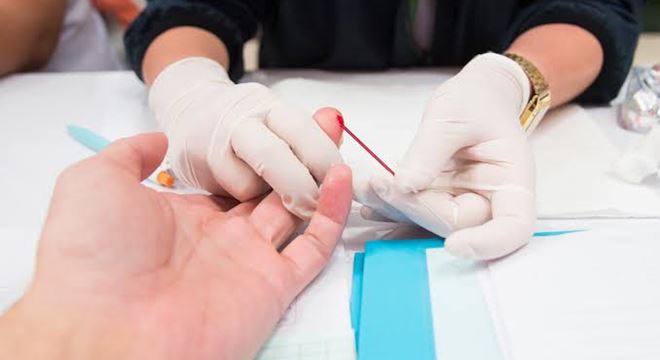 ‘Dezembro Vermelho’ alerta para prevenção e combate ao HIV/Aids — © Divulgação