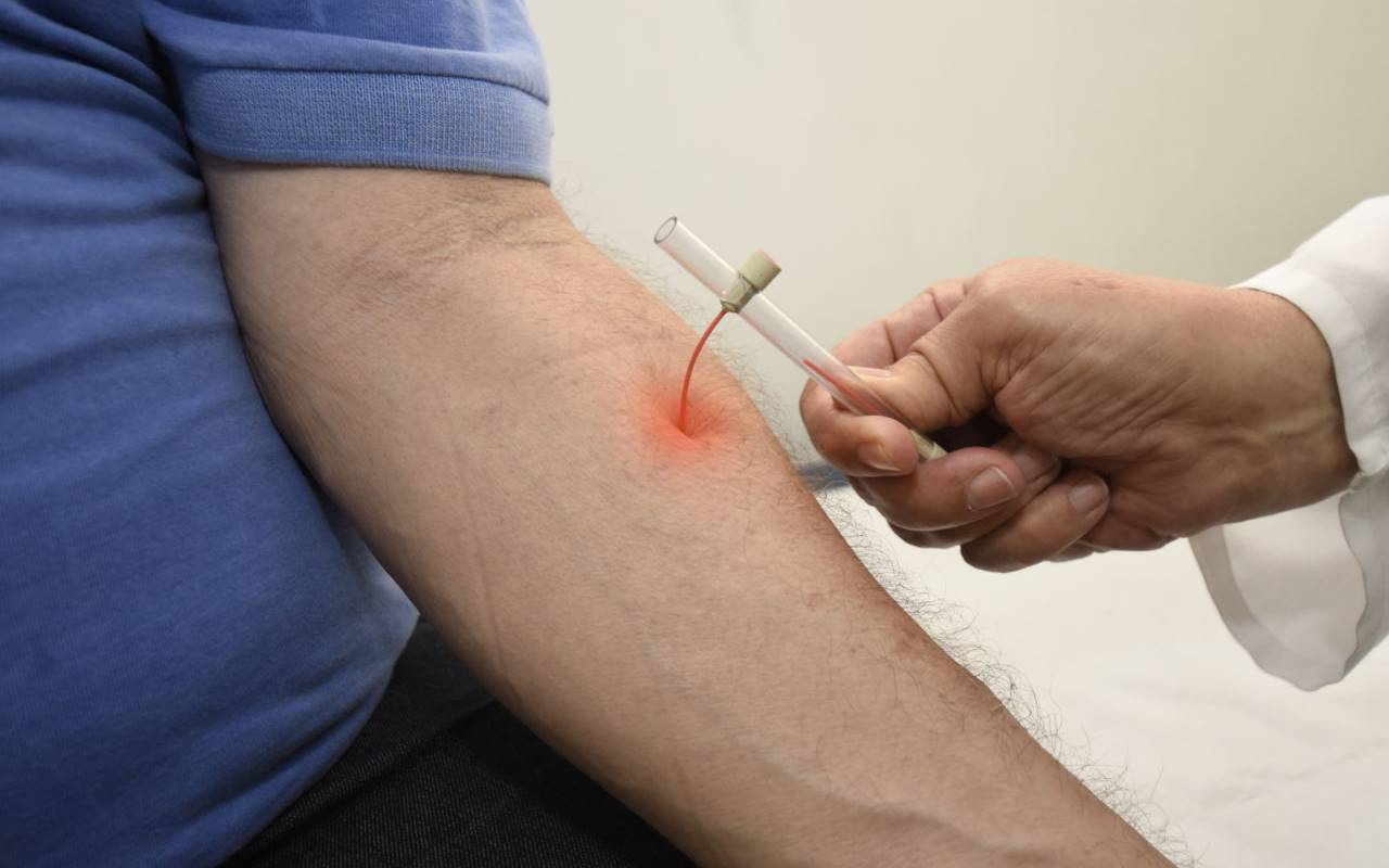 Exame simples pode ser feito em qualquer UBS — © Ilustração