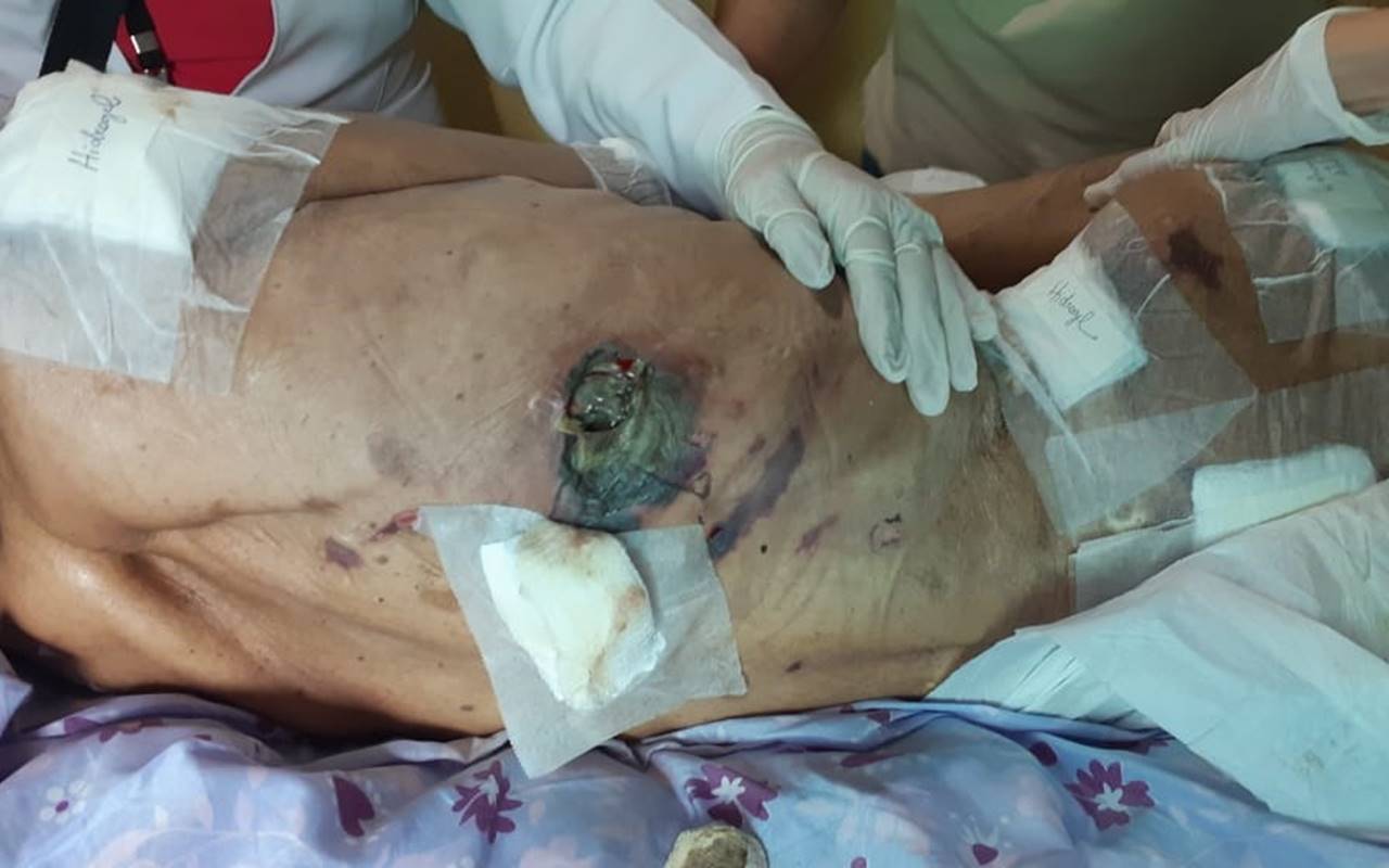 Filha mantinha idosa com ferida aberta até o pulmão — © Reprodução