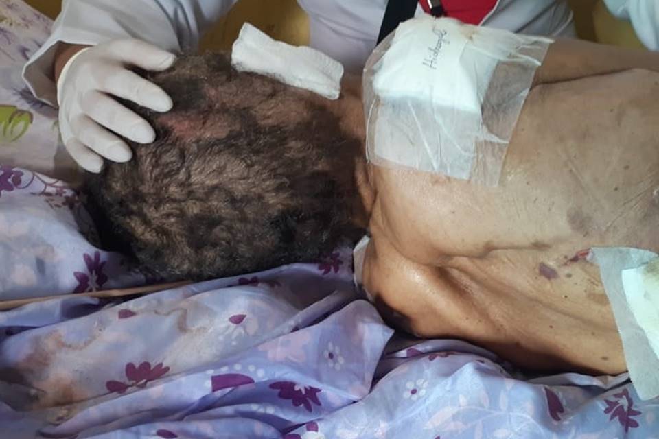 Cenas fortes: Idosa é resgatada suja e com ferida aberta até o pulmão; filha foi presa