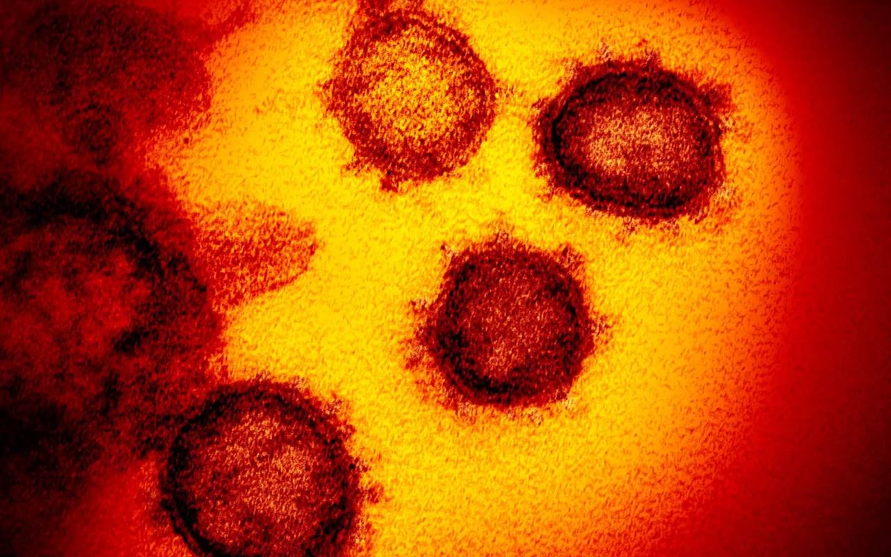 Imagem de microscópico mostra o novo coronavírus Covid-19 — © NIAID-RML/AP
