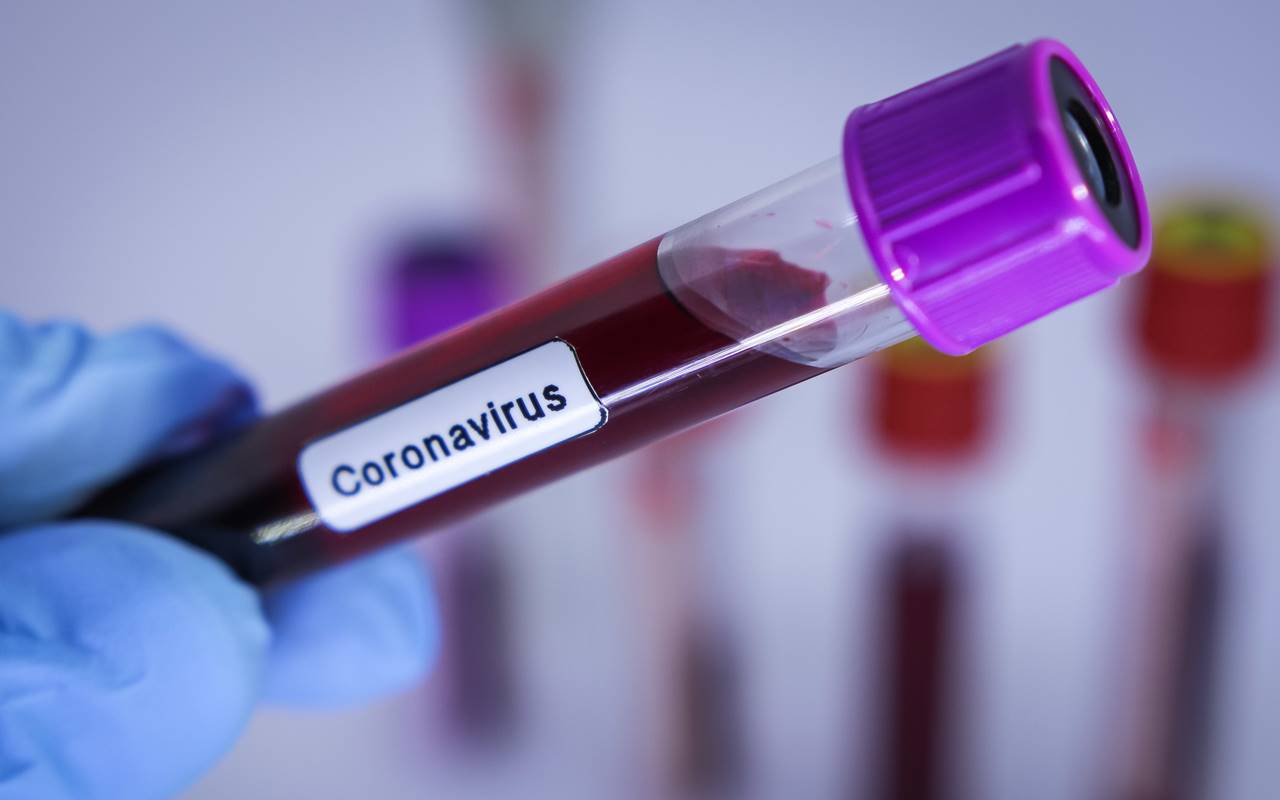 Teste de coronavirus
