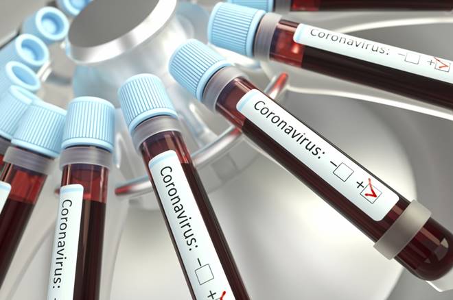 Teste de coronavírus — © Reprodução