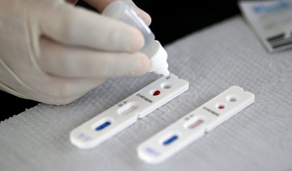 Teste de identificação do novo coronavírus — © Reprodução