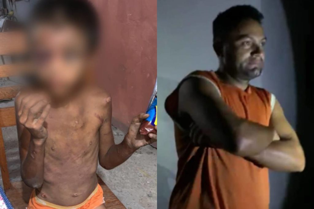 Criança em cárcere privado é resgatada com sinais de estupro, tortura e desnutrição