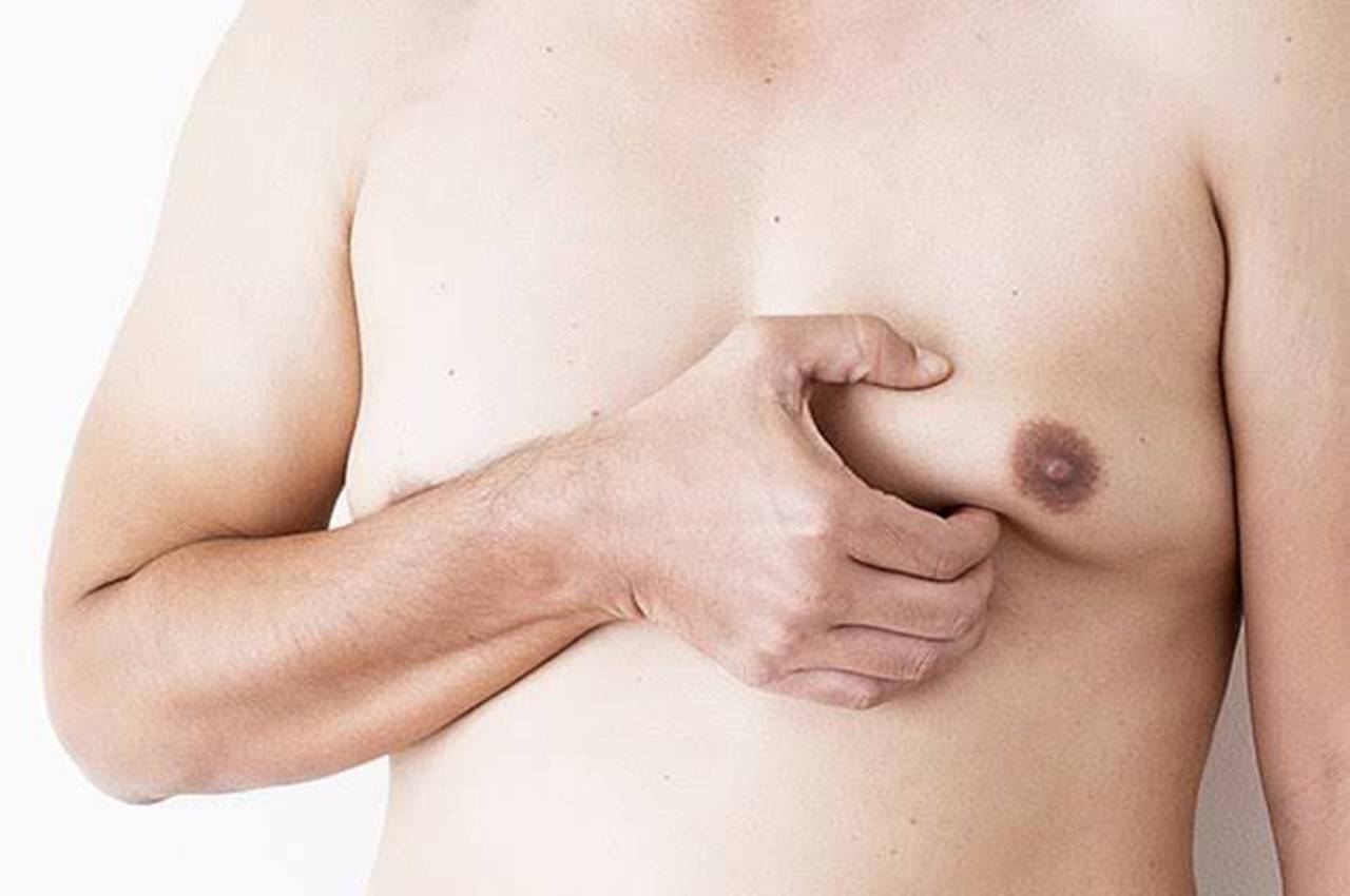 Homens representam 1% do total de casos de câncer de mama no Brasil — © Reprodução