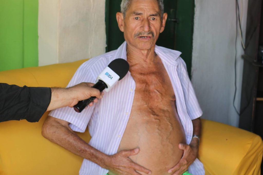 Seu Expedito sofre há mais de um ano com líquido na barriga — © Oziel Nascimento/BR104