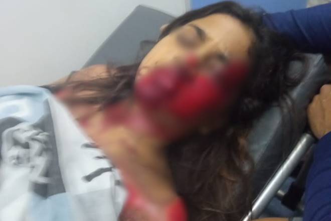 A vítima, uma garota de 12 anos, foi socorrida para o Hospital Regional da Mata — © Cortesia