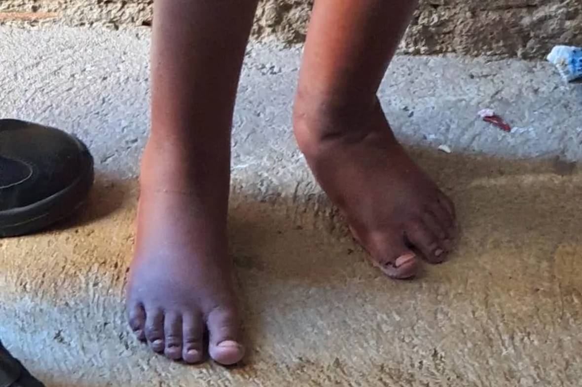 Criança também apresentava pernas inchadas, diz PM — © Polícia Militar