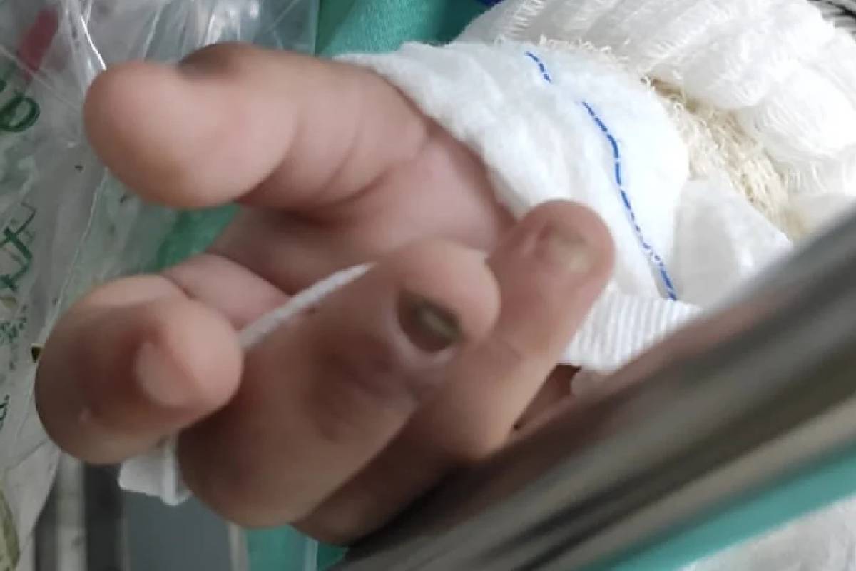 Menina foi levada a hospital sem duas unhas, em Goiânia — © Divulgação