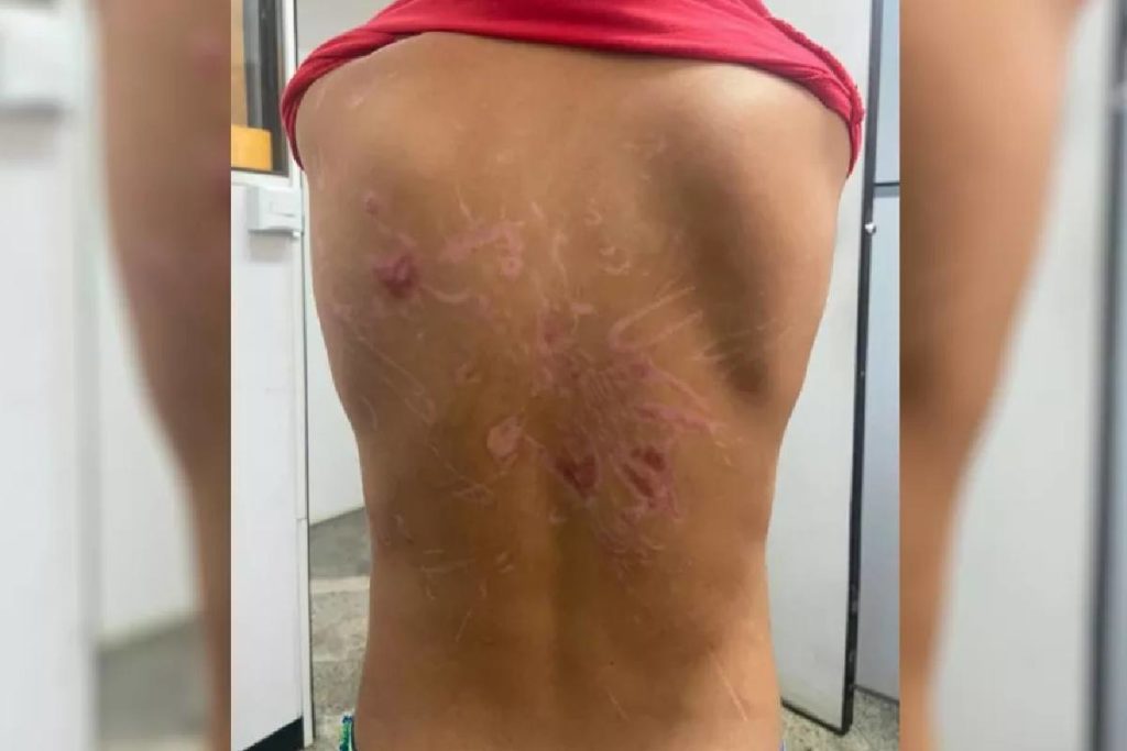 Homem é preso por torturar filho com sessões de choque e afogamento