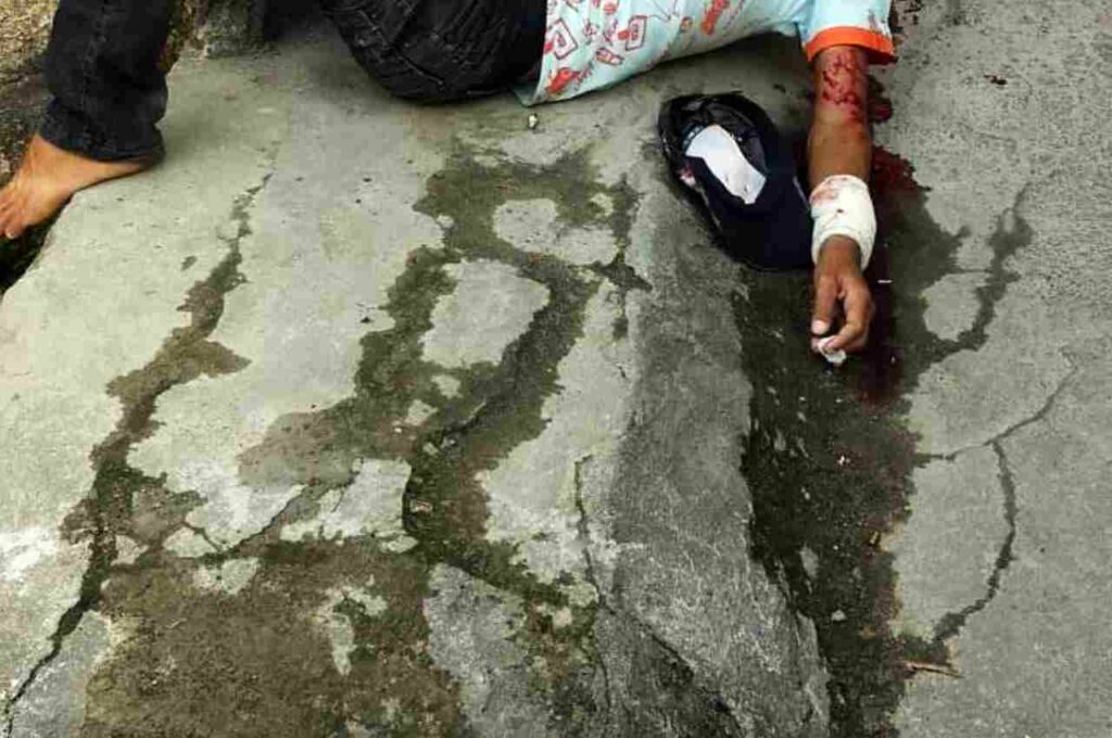 Homem sofre tentativa de homicídio e suspeito é preso em Joaquim Gomes