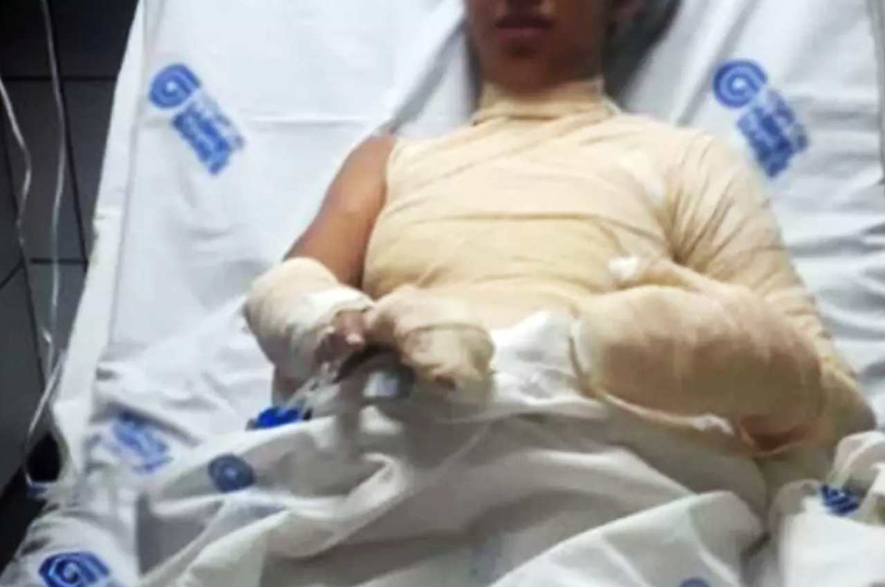 Jovem se recupera de queimaduras em hospital de Aracaju | © Arquivo pessoal