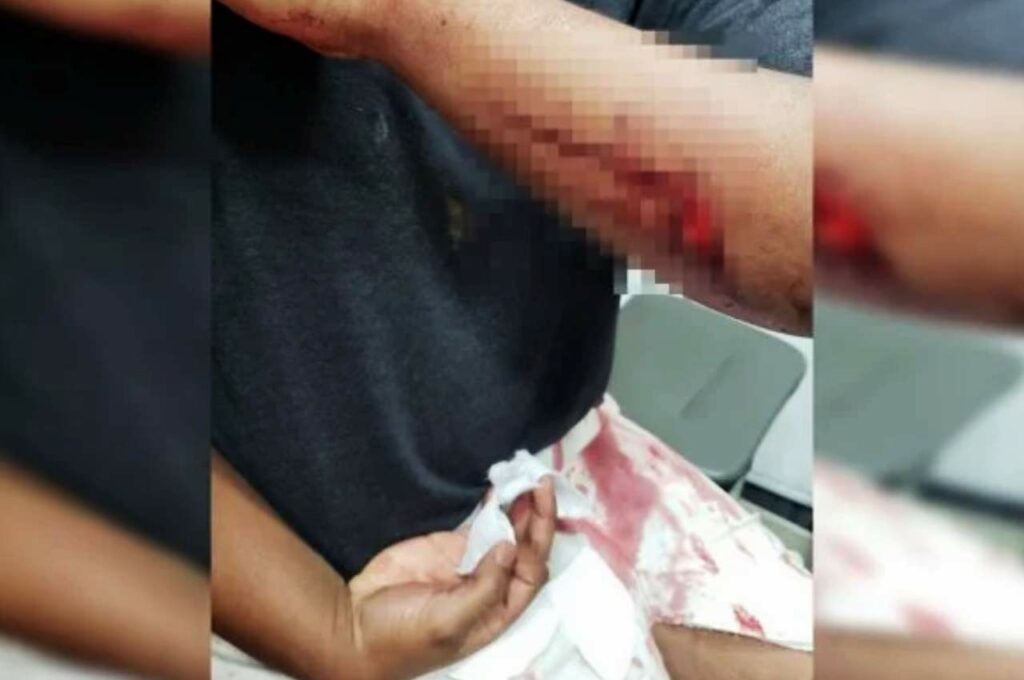 Grávida leva facãozada do avô após intervir em discussão de família