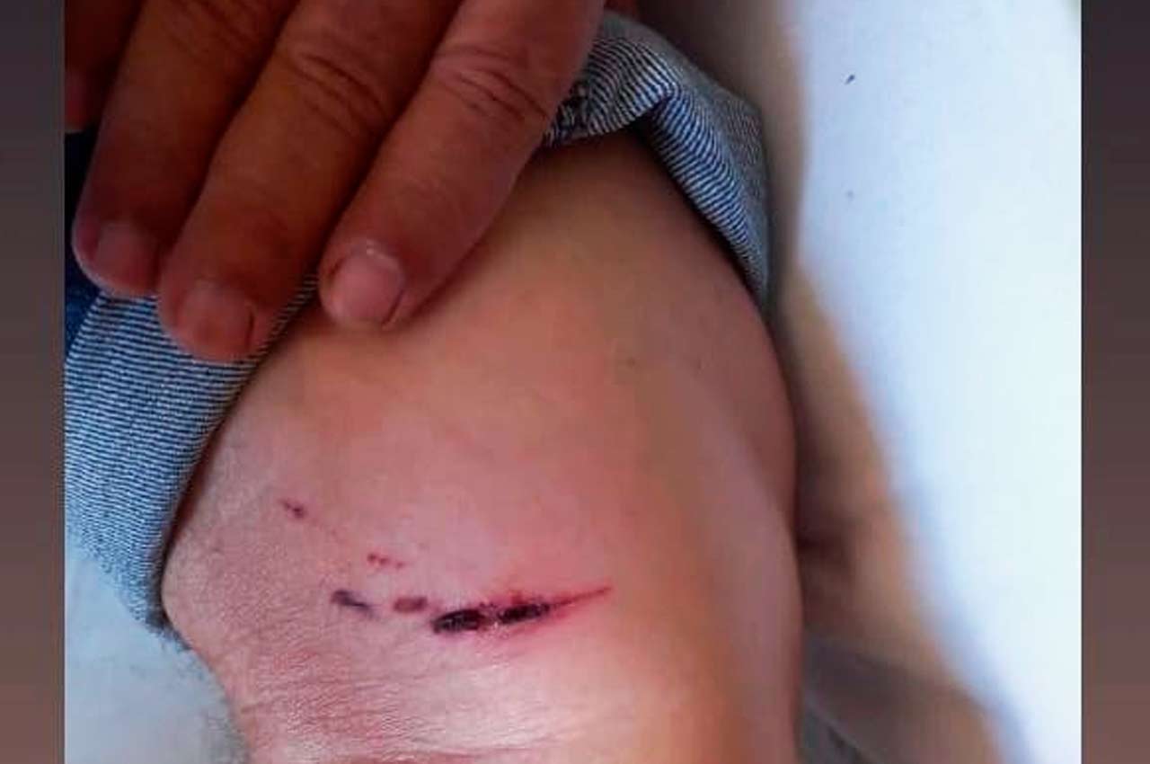 Idoso sofreu um ferimento no braço após ataque de cães | © Reprodução