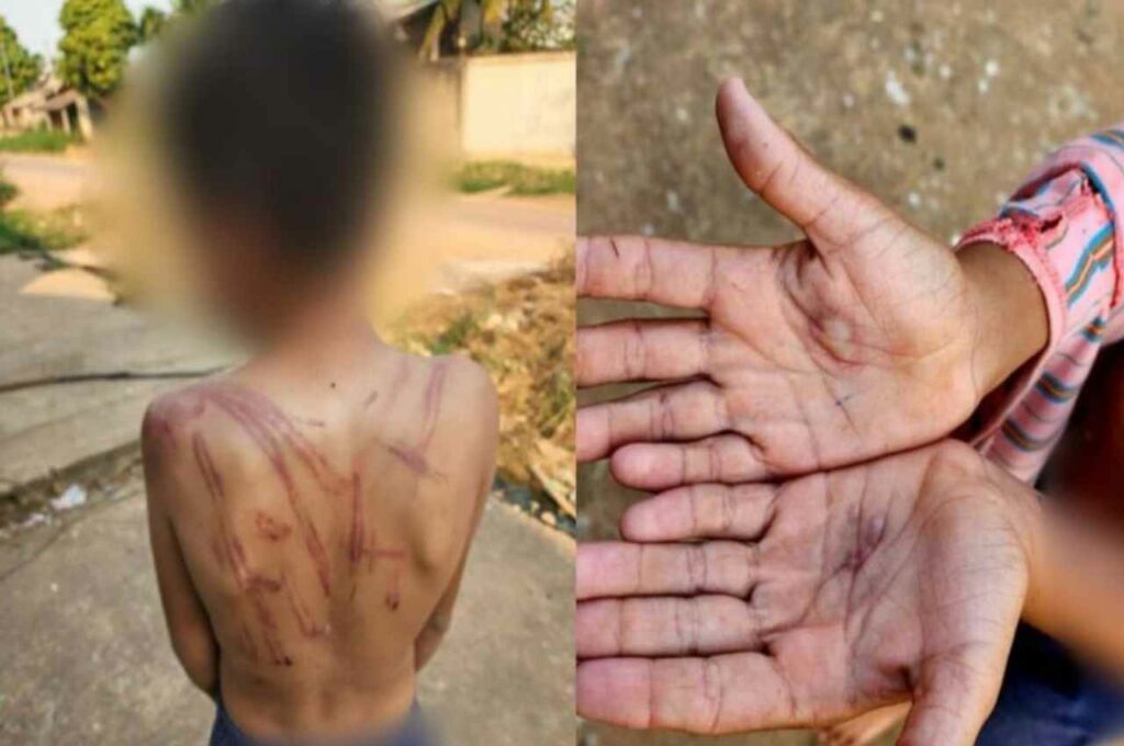 Após espancar, mãe queima mãos de filho com isqueiro por causa de 10 reais