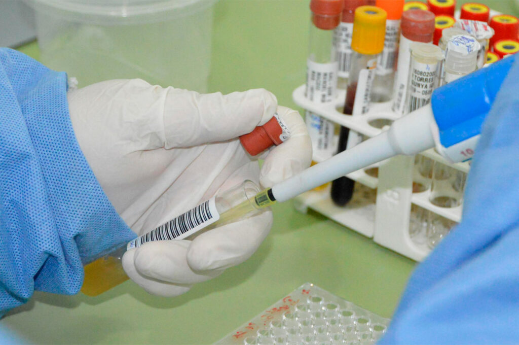 Alagoas tem baixo registro de casos de Covid-19 durante o Carnaval