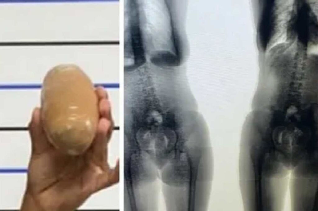 Jovem de 21 anos é presa após tentar entrar com drogas nas partes íntimas em presídio de Maceió