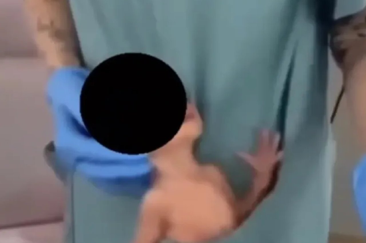 Fisioterapeuta com bebê recém-nascido dentro do bolso de seu jaleco | Foto: reprodução 