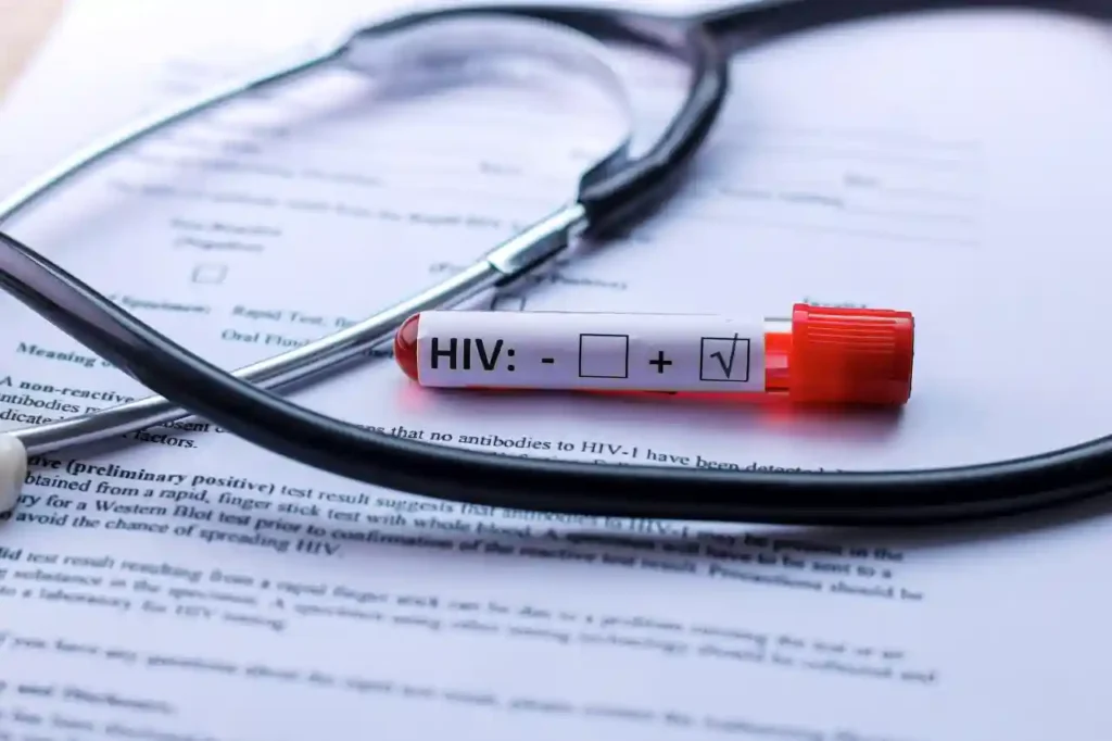 Prefeitura divulga lista com 600 nomes de pessoas com HIV/Aids na Bahia
