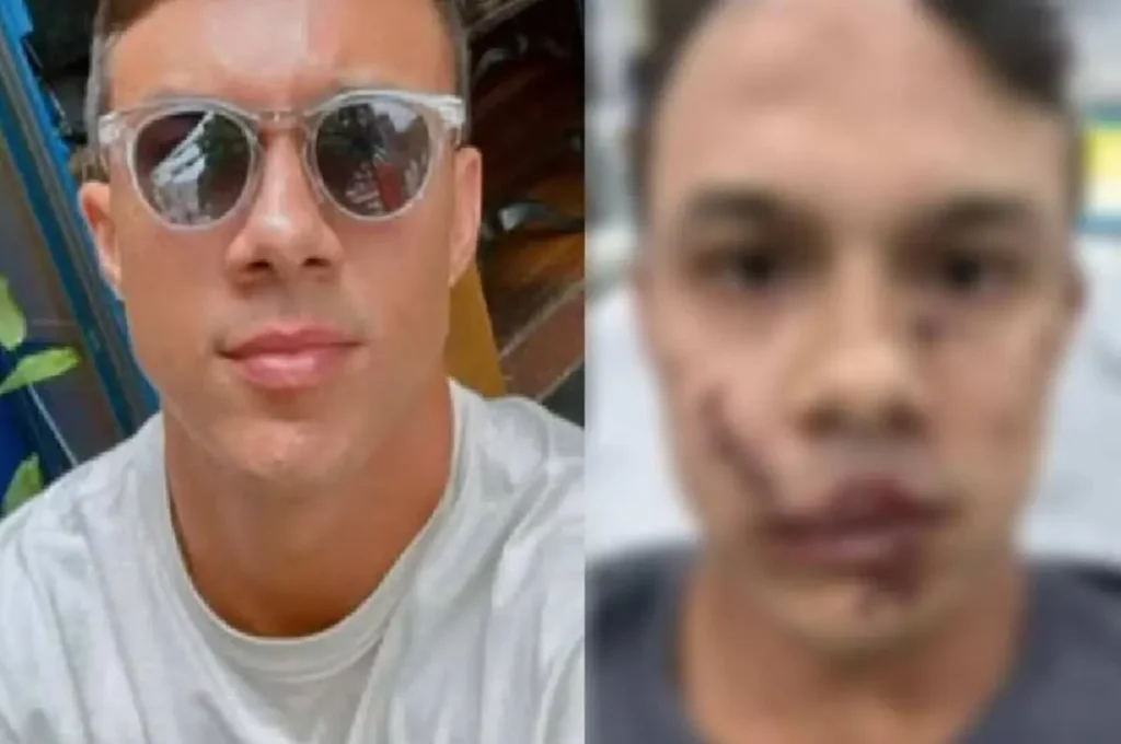 Personal leva 45 pontos no rosto após defender mulheres de assédio em bar