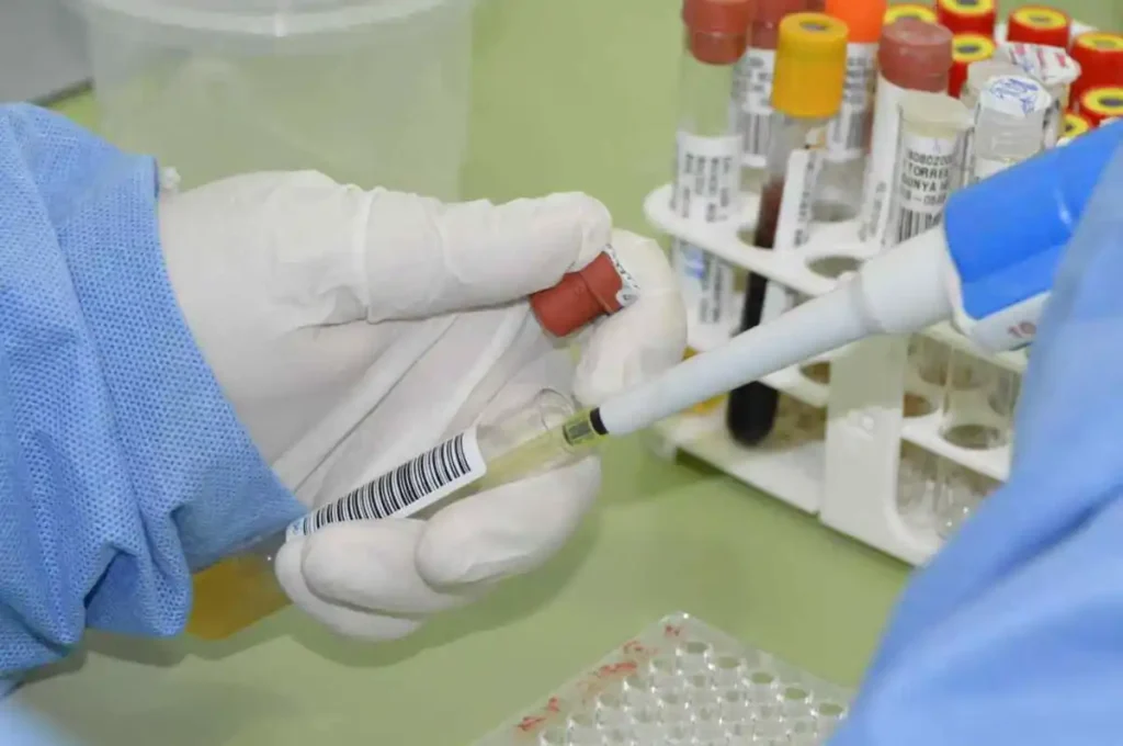 Com sete casos confirmados e duas mortes, Sesau reforça alerta sobre prevenção da meningite em AL