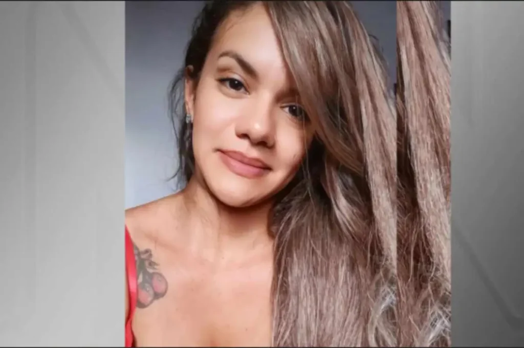 “Como um acidente de moto sem capacete”: cirurgião compara lesões de mulher que levou socos dentro de elevador