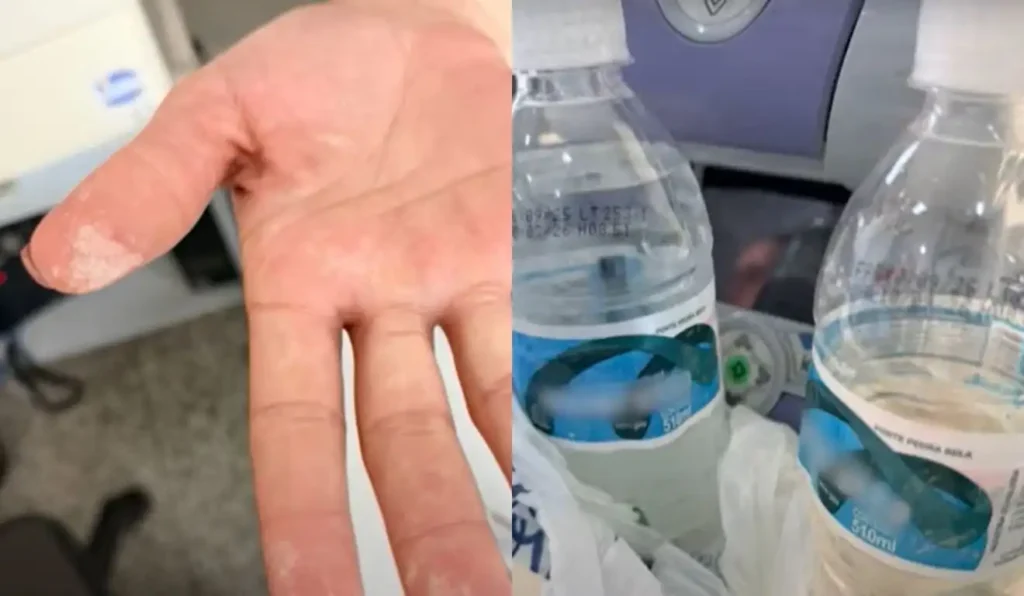 Qual foi a marca da água que deixou o homem internado em São Paulo?