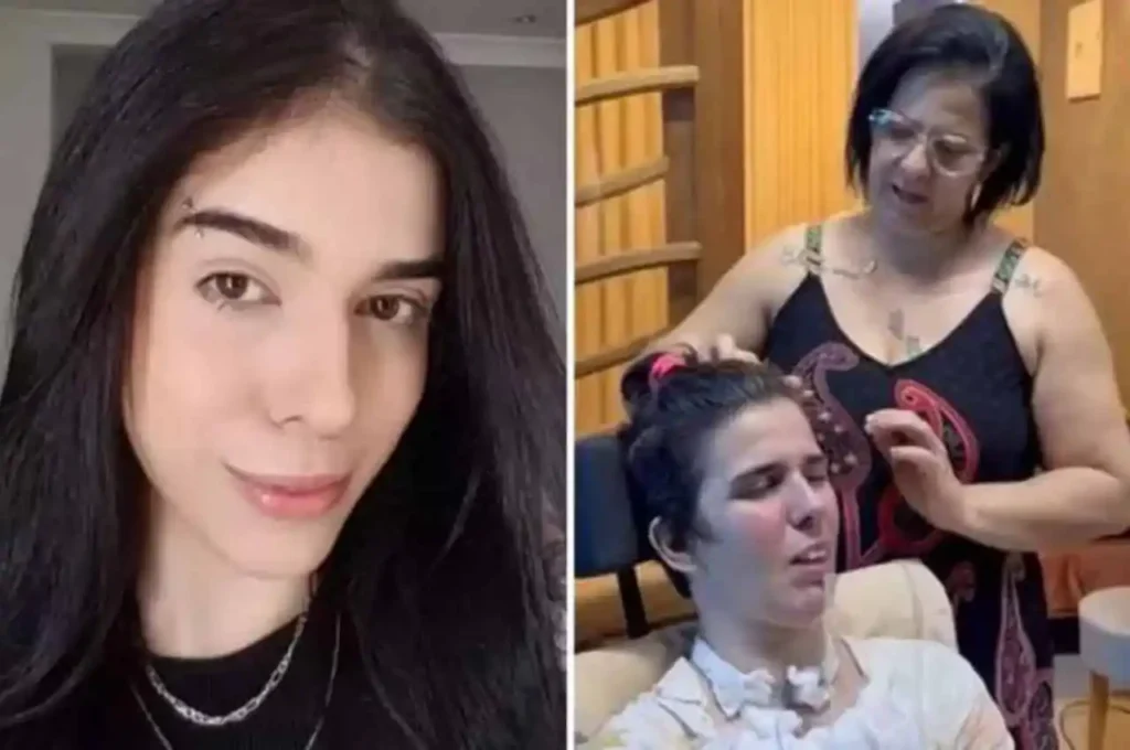 Jovem completa 1.000 dias de reabilitação após grave reação a pimenta