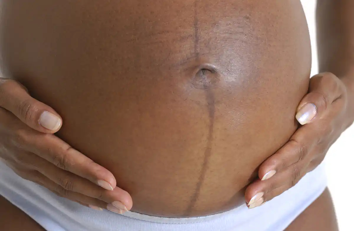 Gravida negra - @Reprodução