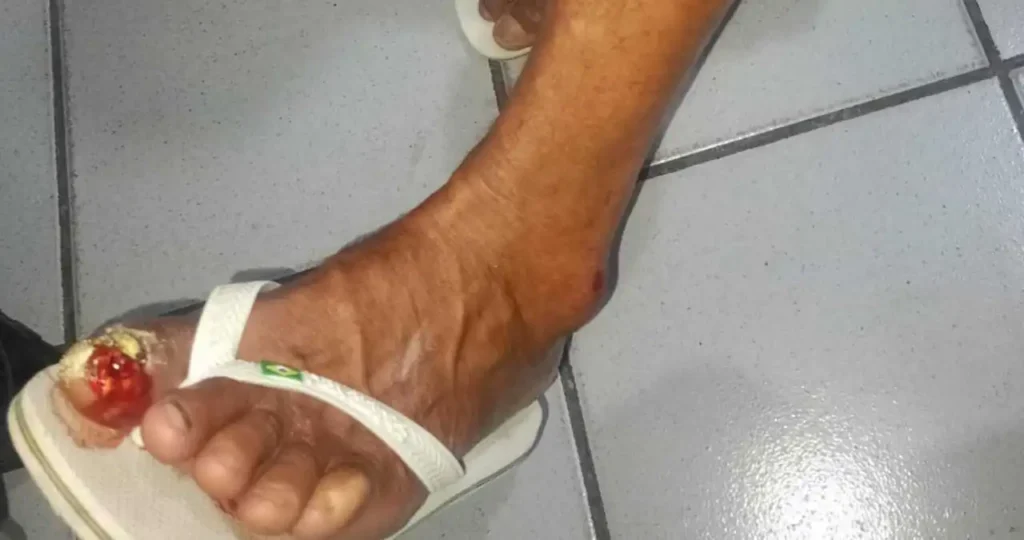 Homem é detido após jogar telha em vizinho durante briga em Santana do Mundaú