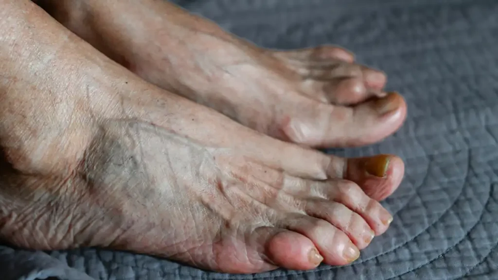 Por que você sente os pés gelados mesmo no calor de Alagoas?